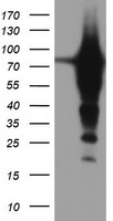 EPN2 Antibody - HEK293T cells were transfected with the pCMV6-ENTRY control (Left lane) or pCMV6-ENTRY EPN2 (Right lane) cDNA for 48 hrs and lysed. Equivalent amounts of cell lysates (5 ug per lane) were separated by SDS-PAGE and immunoblotted with anti-EPN2.
