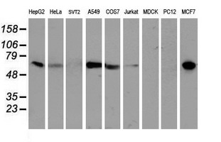 EPN2 Antibody - Western blot of extracts (35ug) from 9 different cell lines by using anti-EPN2 monoclonal antibody.