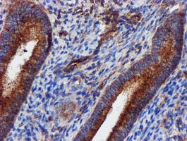 EPN2 Antibody - IHC of paraffin-embedded Human endometrium tissue using anti-EPN2 mouse monoclonal antibody.