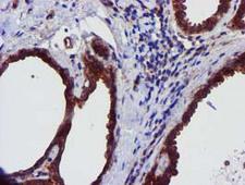 EPN2 Antibody - IHC of paraffin-embedded Human breast tissue using anti-EPN2 mouse monoclonal antibody.