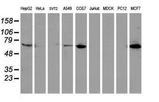 EPN2 Antibody - Western blot of extracts (35 ug) from 9 different cell lines by using anti-EPN2 monoclonal antibody.