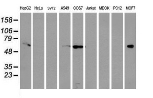 EPN2 Antibody - Western blot of extracts (35ug) from 9 different cell lines by using anti-EPN2 monoclonal antibody.