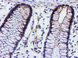 EPN2 Antibody - IHC of paraffin-embedded Human colon tissue using anti-EPN2 mouse monoclonal antibody. (Heat-induced epitope retrieval by 10mM citric buffer, pH6.0, 100C for 10min).