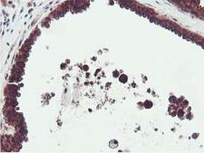EPN2 Antibody - IHC of paraffin-embedded Human breast tissue using anti-EPN2 mouse monoclonal antibody.