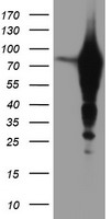 EPN2 Antibody - HEK293T cells were transfected with the pCMV6-ENTRY control (Left lane) or pCMV6-ENTRY EPN2 (Right lane) cDNA for 48 hrs and lysed. Equivalent amounts of cell lysates (5 ug per lane) were separated by SDS-PAGE and immunoblotted with anti-EPN2.