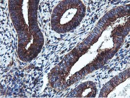EPN2 Antibody - IHC of paraffin-embedded Human endometrium tissue using anti-EPN2 mouse monoclonal antibody. (Heat-induced epitope retrieval by 10mM citric buffer, pH6.0, 100C for 10min).
