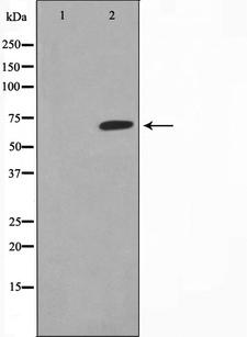 EPN2 Antibody - Western blot analysis on HepG2 cell lysates using EPN2 antibody. The lane on the left is treated with the antigen-specific peptide.