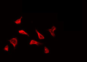 EPN2 Antibody - Staining HepG2 cells by IF/ICC. The samples were fixed with PFA and permeabilized in 0.1% Triton X-100, then blocked in 10% serum for 45 min at 25°C. The primary antibody was diluted at 1:200 and incubated with the sample for 1 hour at 37°C. An Alexa Fluor 594 conjugated goat anti-rabbit IgG (H+L) Ab, diluted at 1/600, was used as the secondary antibody.