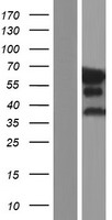 EPN2 Protein - Western validation with an anti-DDK antibody * L: Control HEK293 lysate R: Over-expression lysate