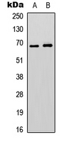 EPN3 Antibody - Western blot analysis of EPN3 expression in SHSY5Y (A); HEK293T (B) whole cell lysates.