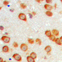 EPN3 Antibody - Immunohistochemical analysis of EPN3 staining in human brain formalin fixed paraffin embedded tissue section. The section was pre-treated using heat mediated antigen retrieval with sodium citrate buffer (pH 6.0). The section was then incubated with the antibody at room temperature and detected using an HRP conjugated compact polymer system. DAB was used as the chromogen. The section was then counterstained with hematoxylin and mounted with DPX.