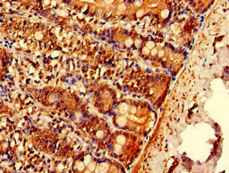 EPN3 Antibody - Immunohistochemistry image of paraffin-embedded human small intestine tissue at a dilution of 1:100