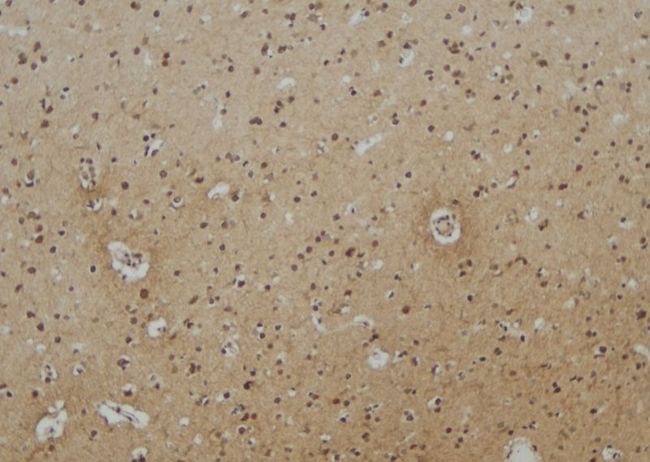 EPN3 Antibody - 1:100 staining human brain tissue by IHC-P. The sample was formaldehyde fixed and a heat mediated antigen retrieval step in citrate buffer was performed. The sample was then blocked and incubated with the antibody for 1.5 hours at 22°C. An HRP conjugated goat anti-rabbit antibody was used as the secondary.