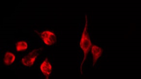 EPN3 Antibody - Staining K562 cells by IF/ICC. The samples were fixed with PFA and permeabilized in 0.1% Triton X-100, then blocked in 10% serum for 45 min at 25°C. The primary antibody was diluted at 1:200 and incubated with the sample for 1 hour at 37°C. An Alexa Fluor 594 conjugated goat anti-rabbit IgG (H+L) Ab, diluted at 1/600, was used as the secondary antibody.