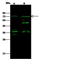 EPN3 Antibody - Anti-EPN3 rabbit polyclonal antibody at 1:500 dilution. Lane A: MCF7 Whole Cell Lysate. Lane B: K562 Whole Cell Lysate. Lysates/proteins at 30 ug per lane. Secondary: Goat Anti-Rabbit IgG H&L (Dylight 800) at 1/10000 dilution. Developed using the Odyssey technique. Performed under reducing conditions. Predicted band size: 68 kDa. Observed band size: 72 kDa. (We are unsure as to the identity of these extra bands.)