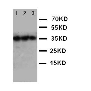 EPO / Erythropoietin Antibody - WB of Erythropoietin / EPO antibody. Lane 1: Recombinant human EPO Protein 10ng . Lane 2: Recombinant human EPO Protein 5ng . Lane 3: Recombinant human EPO Protein 2.5ng..