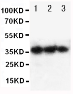 EPO / Erythropoietin Antibody - Anti-human EPO antibody, Western blotting Lane 1: Recombinant human EPO Protein 10ng Lane 2: Recombinant human EPO Protein 5ng Lane 3: Recombinant human EPO Protein 2