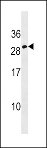 EPO / Erythropoietin Antibody - Erythropoietin Antibody western blot of CEM cell line lysates (35 ug/lane). The Erythropoietin antibody detected the Erythropoietin protein (arrow).