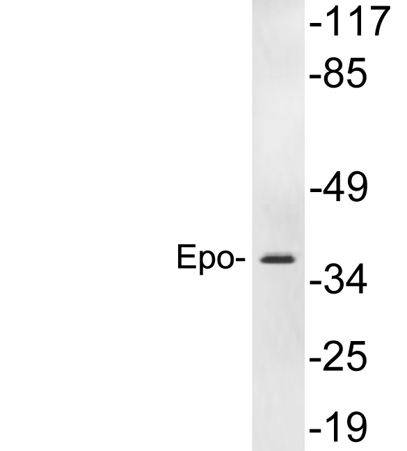 EPO / Erythropoietin Antibody - Western blot analysis of lysates from HepG2 cells, using Epo antibody.