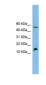 EPO / Erythropoietin Antibody - EPO / Erythropoietin antibody Western blot of HepG2 cell lysate. This image was taken for the unconjugated form of this product. Other forms have not been tested.