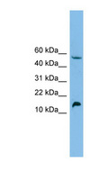 EPO / Erythropoietin Antibody - EPO / Erythropoietin antibody Western blot of HepG2 cell lysate. This image was taken for the unconjugated form of this product. Other forms have not been tested.