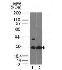 EPO / Erythropoietin Antibody - Western blot testing of with EPO antibody (clone EPO/1368). Predicted molecular weight: 18-34 kDa depending on glycosylation level.