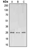 EPO / Erythropoietin Antibody - Western blot analysis of EPO expression in A549 (A); SP2/0 (B); PC12 (C) whole cell lysates.
