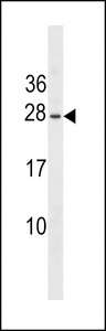 EPO / Erythropoietin Antibody - Erythropoietin Antibody western blot of WiDr cell line lysates (35 ug/lane). The Erythropoietin antibody detected the Erythropoietin protein (arrow).