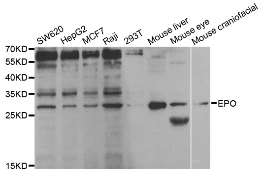 EPO / Erythropoietin Antibody - Western blot analysis of extracts of various cell lines, using EPO antibody.