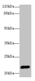EPO / Erythropoietin Antibody - Western blot All lanes: EPO antibody at 3µg/ml + HepG2 whole cell lysate Secondary Goat polyclonal to rabbit IgG at 1/10000 dilution Predicted band size: 21 kDa Observed band size: 21 kDa