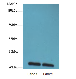 EPO / Erythropoietin Antibody - Western blot. All lanes: EPO antibody at 6 ug/ml. Lane 1: Mouse liver tissue. Lane 2: Mouse kidney tissue. Secondary Goat polyclonal to Rabbit IgG at 1:10000 dilution. Predicted band size: 21 kDa. Observed band size: 21 kDa.