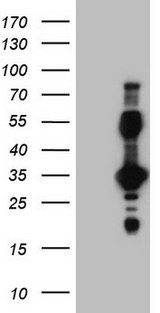 EPOR / EPO Receptor Antibody - Human recombinant protein fragment corresponding to amino acids 25-250 of human EPOR. (NP_000112) produced in E.coli.