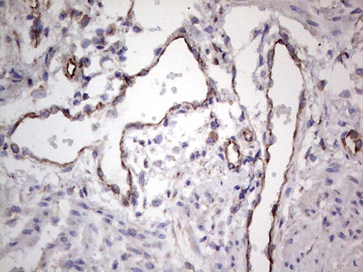 EPOR / EPO Receptor Antibody - Immunohistochemical staining of paraffin-embedded Human endometrium tissue within the normal limits using anti-EPOR mouse monoclonal antibody. (Heat-induced epitope retrieval by 1 mM EDTA in 10mM Tris, pH8.5, 120C for 3min,
