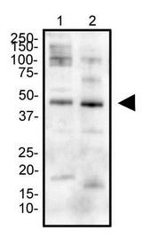 EPOR / EPO Receptor Antibody - Western Blot: EPO Receptor Antibody - Western blot analysis of K562 (left) and SH-SY5Y (right) cell lysate using EPO receptor antibody at a concentration of 2 ug/ml.