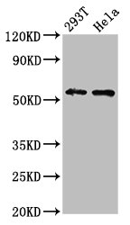 EPOR / EPO Receptor Antibody - Positive Western Blot detected in 293T whole cell lysate, Hela whole cell lysate. All lanes: EPOR antibody at 4.3 µg/ml Secondary Goat polyclonal to rabbit IgG at 1/50000 dilution. Predicted band size: 56, 27, 36 KDa. Observed band size: 56 KDa