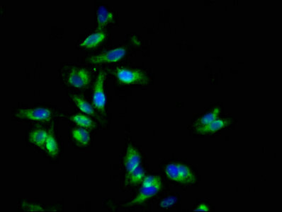 EPOR / EPO Receptor Antibody - Immunofluorescence staining of Hela cells with EPOR Antibody at 1:133, counter-stained with DAPI. The cells were fixed in 4% formaldehyde, permeabilized using 0.2% Triton X-100 and blocked in 10% normal Goat Serum. The cells were then incubated with the antibody overnight at 4°C. The secondary antibody was Alexa Fluor 488-congugated AffiniPure Goat Anti-Rabbit IgG(H+L).