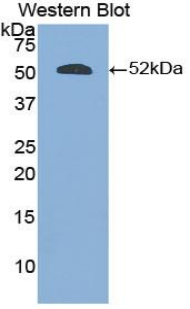 EPOR / EPO Receptor Antibody - Western blot of recombinant EPOR / EPO Receptor.  This image was taken for the unconjugated form of this product. Other forms have not been tested.