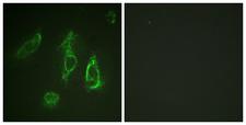 EPOR / EPO Receptor Antibody - Immunofluorescence analysis of HeLa cells, using Epo-R Antibody. The picture on the right is blocked with the synthesized peptide.