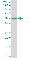 EPOR / EPO Receptor Antibody - EPOR monoclonal antibody (M01), clone 3D10. Western Blot analysis of EPOR expression in HeLa.
