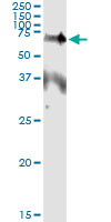 EPOR / EPO Receptor Antibody - Immunoprecipitation of EPOR transfected lysate using anti-EPOR monoclonal antibody and Protein A Magnetic Bead, and immunoblotted with EPOR rabbit polyclonal antibody.