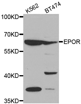 EPOR / EPO Receptor Antibody - Western blot analysis of extracts of various cell lines, using EPOR antibody.