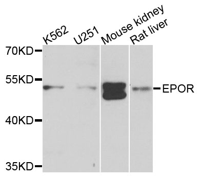 EPOR / EPO Receptor Antibody - Western blot analysis of extracts of various cells.
