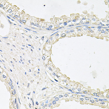 EPOR / EPO Receptor Antibody - Immunohistochemistry of paraffin-embedded human prostate.