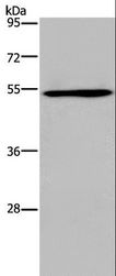 EPOR / EPO Receptor Antibody - Western blot analysis of A549 cell, using EPOR Polyclonal Antibody at dilution of 1:500.