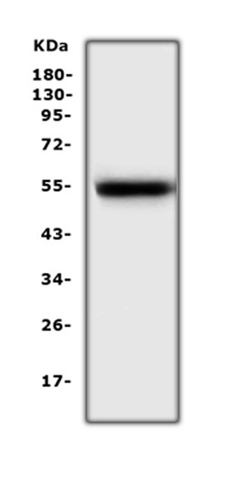 EPOR / EPO Receptor Antibody - Western blot analysis of EPO Receptor using anti-EPO Receptor antibody. Electrophoresis was performed on a 5-20% SDS-PAGE gel at 70V (Stacking gel) / 90V (Resolving gel) for 2-3 hours. The sample well of each lane was loaded with 50ug of sample under reducing conditions. Lane 1: rat lung tissue lysates. After Electrophoresis, proteins were transferred to a Nitrocellulose membrane at 150mA for 50-90 minutes. Blocked the membrane with 5% Non-fat Milk/ TBS for 1.5 hour at RT. The membrane was incubated with rabbit anti-EPO Receptor antigen affinity purified polyclonal antibody at 0.5 µg/mL overnight at 4°C, then washed with TBS-0.1% Tween 3 times with 5 minutes each and probed with a goat anti-rabbit IgG-HRP secondary antibody at a dilution of 1:10000 for 1.5 hour at RT. The signal is developed using an Enhanced Chemiluminescent detection (ECL) kit with Tanon 5200 system. A specific band was detected for EPO Receptor at approximately 55KD. The expected band size for EPO Receptor is at 55KD.