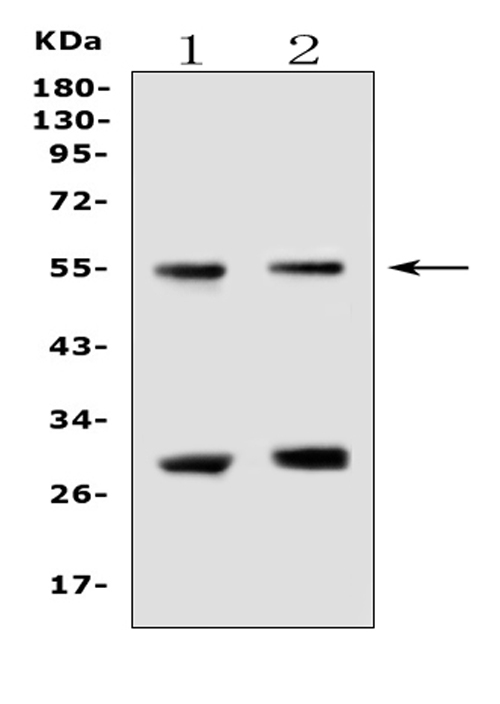EPOR / EPO Receptor Antibody - Western blot analysis of EPO Receptor using anti-EPO Receptor antibody. Electrophoresis was performed on a 5-20% SDS-PAGE gel at 70V (Stacking gel) / 90V (Resolving gel) for 2-3 hours. The sample well of each lane was loaded with 50ug of sample under reducing conditions. Lane 1: human U87-MG whole cell lysates, Lane 2: human A431 whole cell lysates. After Electrophoresis, proteins were transferred to a Nitrocellulose membrane at 150mA for 50-90 minutes. Blocked the membrane with 5% Non-fat Milk/ TBS for 1.5 hour at RT. The membrane was incubated with rabbit anti-EPO Receptor antigen affinity purified polyclonal antibody at 0.5 µg/mL overnight at 4°C, then washed with TBS-0.1% Tween 3 times with 5 minutes each and probed with a goat anti-rabbit IgG-HRP secondary antibody at a dilution of 1:10000 for 1.5 hour at RT. The signal is developed using an Enhanced Chemiluminescent detection (ECL) kit with Tanon 5200 system. A specific band was detected for EPO Receptor at approximately 55KD. The expected band size for EPO Receptor is at 55KD.