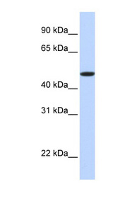 EPOR / EPO Receptor Antibody - EPOR / EPO Receptor antibody Western blot of Fetal Brain lysate. This image was taken for the unconjugated form of this product. Other forms have not been tested.