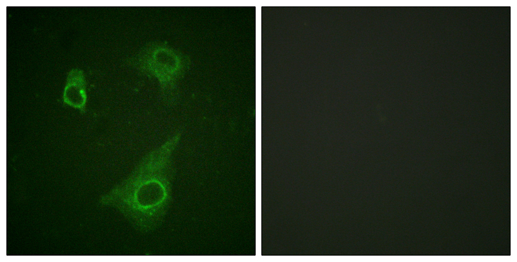 EPOR / EPO Receptor Antibody - Immunofluorescence analysis of HepG2 cells, using Epo-R (Phospho-Tyr368) Antibody. The picture on the right is blocked with the phospho peptide.