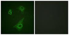 EPOR / EPO Receptor Antibody - Immunofluorescence analysis of HepG2 cells, using Epo-R (Phospho-Tyr368) Antibody. The picture on the right is blocked with the phospho peptide.