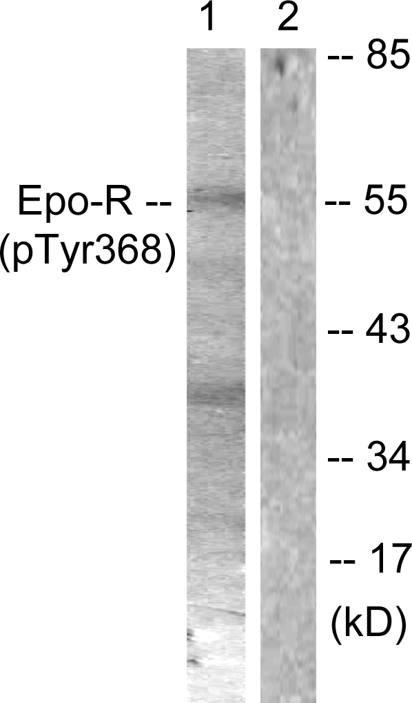 EPOR / EPO Receptor Antibody - Western blot analysis of lysates from K562 cells, using Epo-R (Phospho-Tyr368) Antibody. The lane on the right is blocked with the phospho peptide.